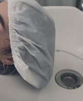 Ozonioterapia Capilar